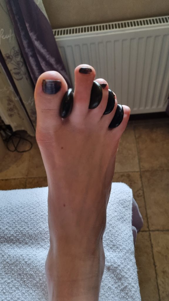 fotbehandling hos Anna-Lenas massage